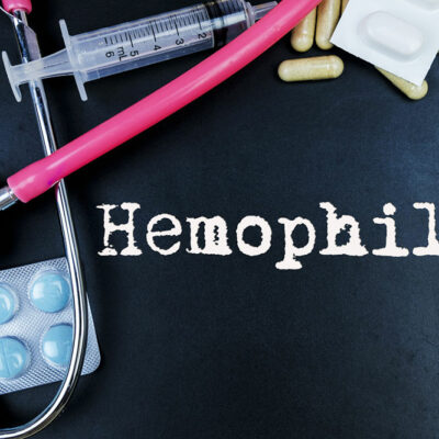 4 Probable Risk Factors for Hemophilia