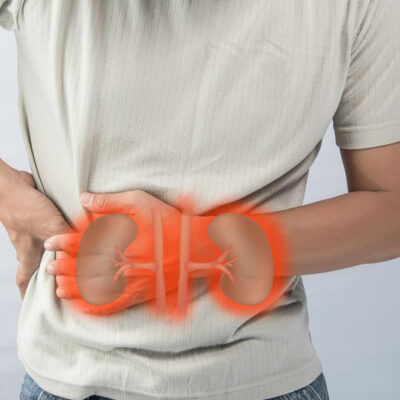 5 Early Warning Signs of Kidney Cancer