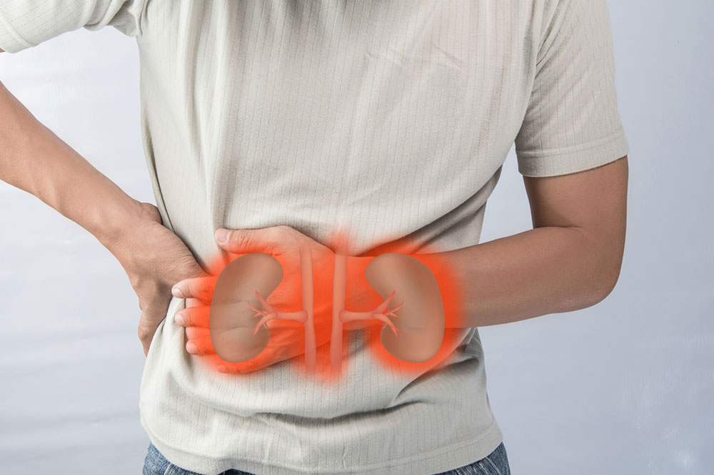 5 Early Warning Signs of Kidney Cancer